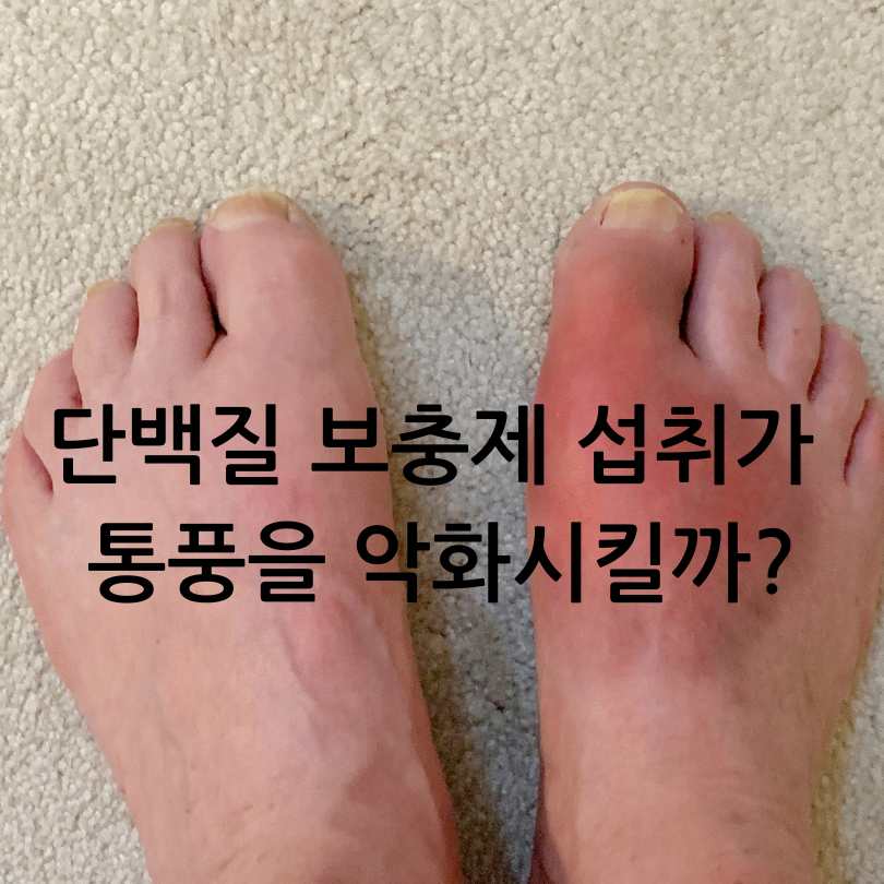 통풍과단백질보충제관계
