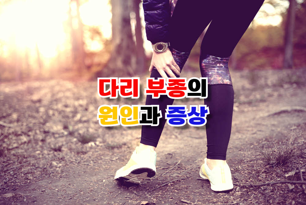  다리 부종의 원인과 증상 및 자가 치료법은?!
