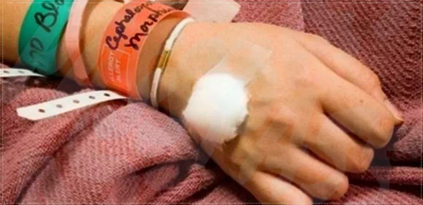 정맥 주사(IV) 또는 채혈 후 상태