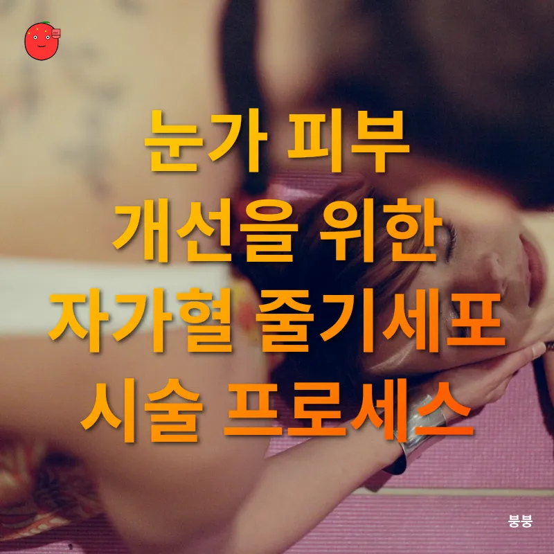 자가혈 줄기세포 시술_2