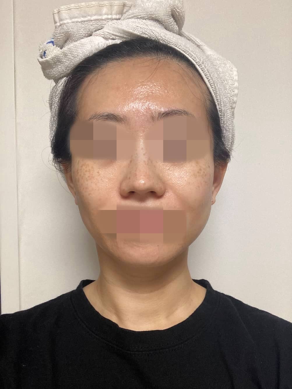 메디테라피 멜라쥬란 화이트닝 크림 사용 2일차