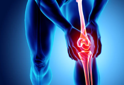 무릎에 물이 차는 증상 물이 찼을때 6