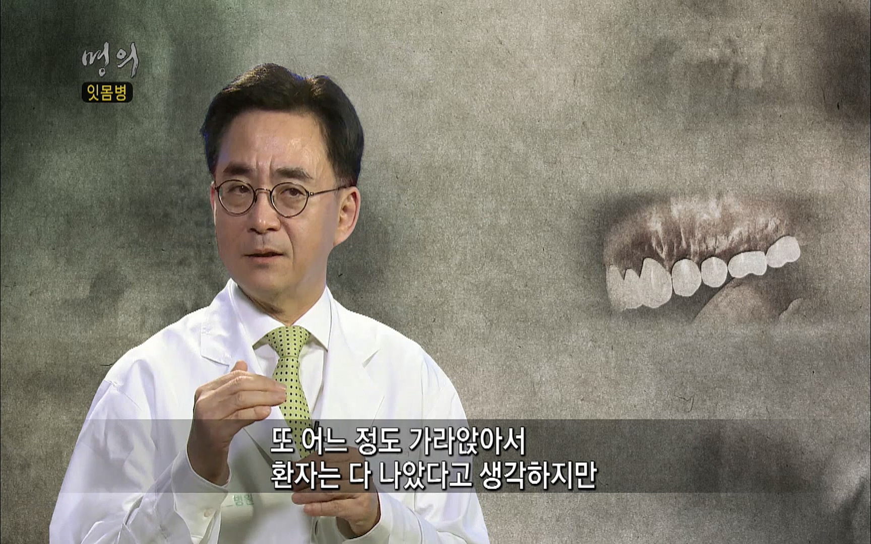 EBS 명의 헬스케어 - TV - 교육의 중심 EBS2015년 1월 16일 (금) 밤 9시 50분, EBS1.mp4_20220505_150356.774.jpg