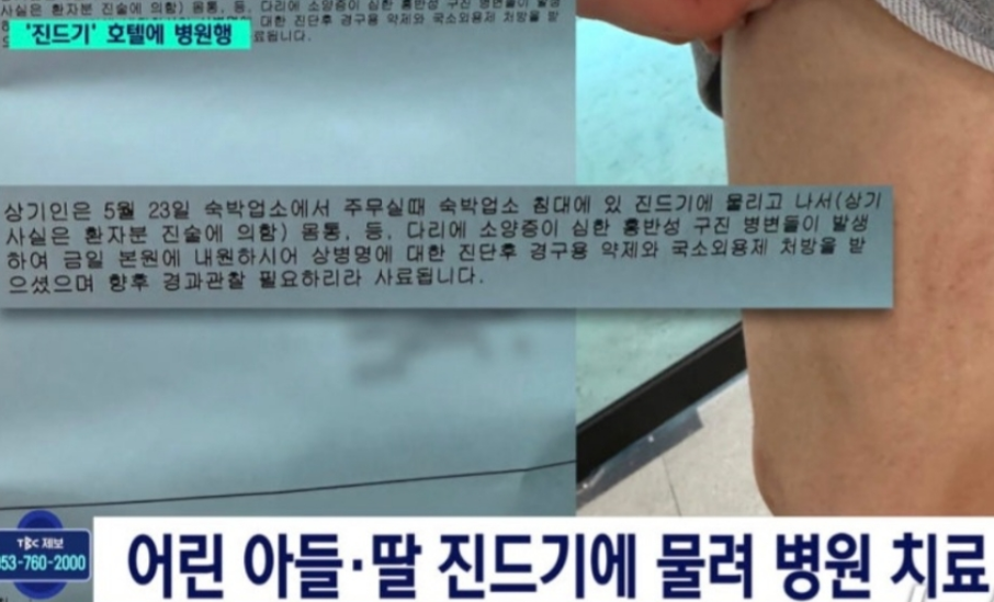 온몸에 빨갛게… 아이들까지 병원행 출처:해럴드경제