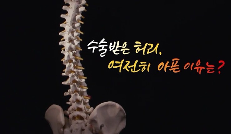 척추