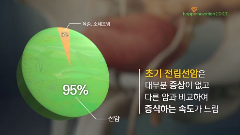  전립선암 초기증상 3기 생존율