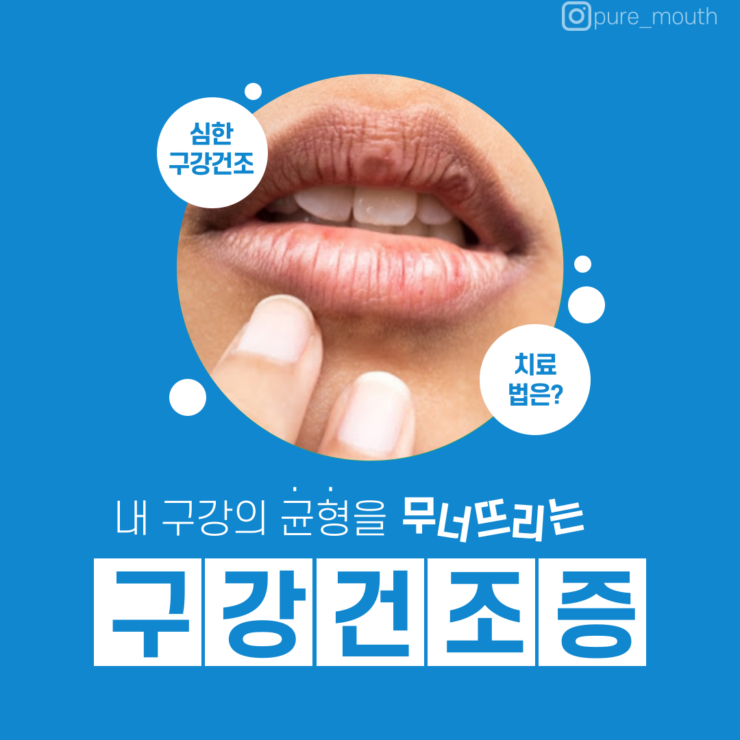  [구강케어]내 구강의 균형을 무너뜨리는 구강건조증 치료법은?
