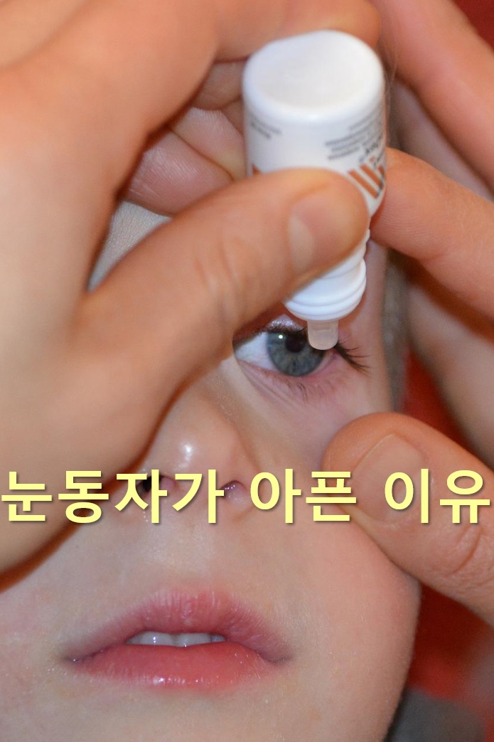  눈동자가 아픈 이유와 눈동자가 떨리는 이유