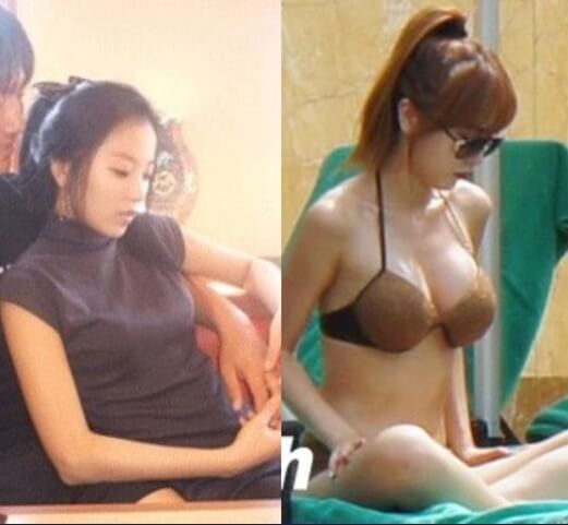 인터넷에 돌고 있는 가슴 성형에 대한 의혹 사진 비슷한 각도 비교