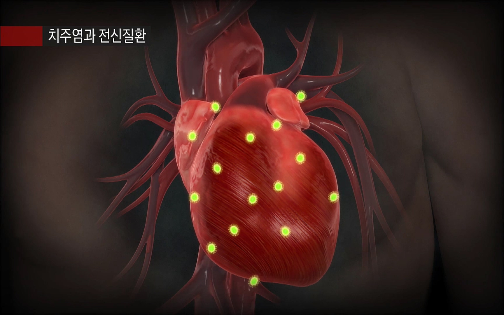 EBS 명의 헬스케어 - TV - 교육의 중심 EBS2015년 1월 16일 (금) 밤 9시 50분, EBS1.mp4_20220505_150402.960.jpg