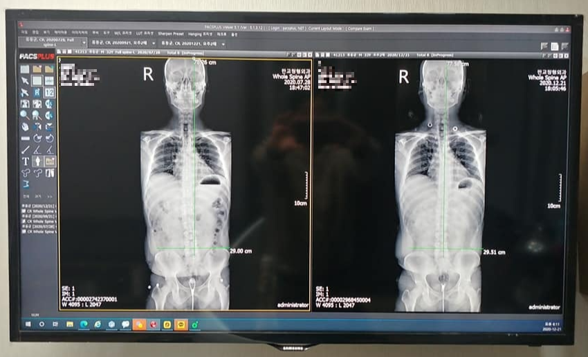 판교정형외과 X-ray