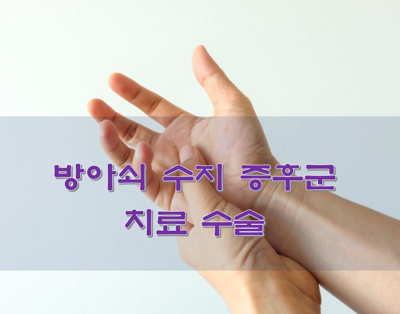  방아쇠 수지 증후군 치료 수술