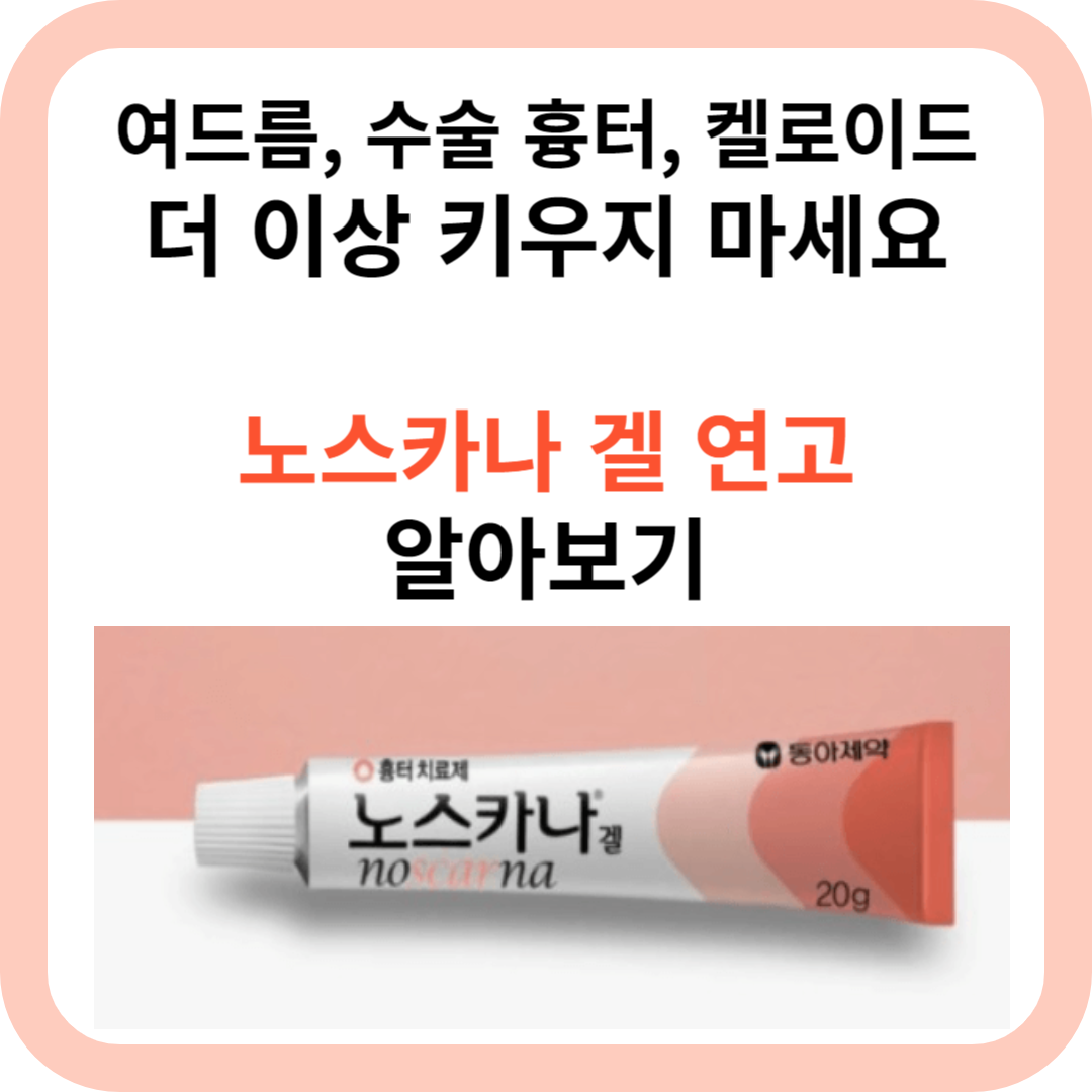 노스카나 겔 연고 추천 효과&#44; 구매&#44; 가격&#44; 사용방법