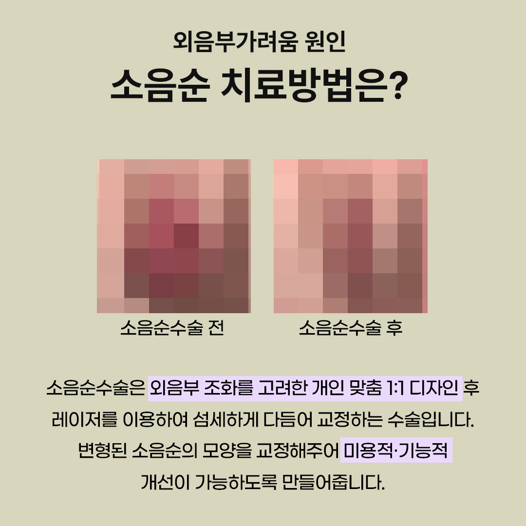 정자역산부인과
외음부가려움
한 번의 과정으로 증상을 호전하고 싶다면?