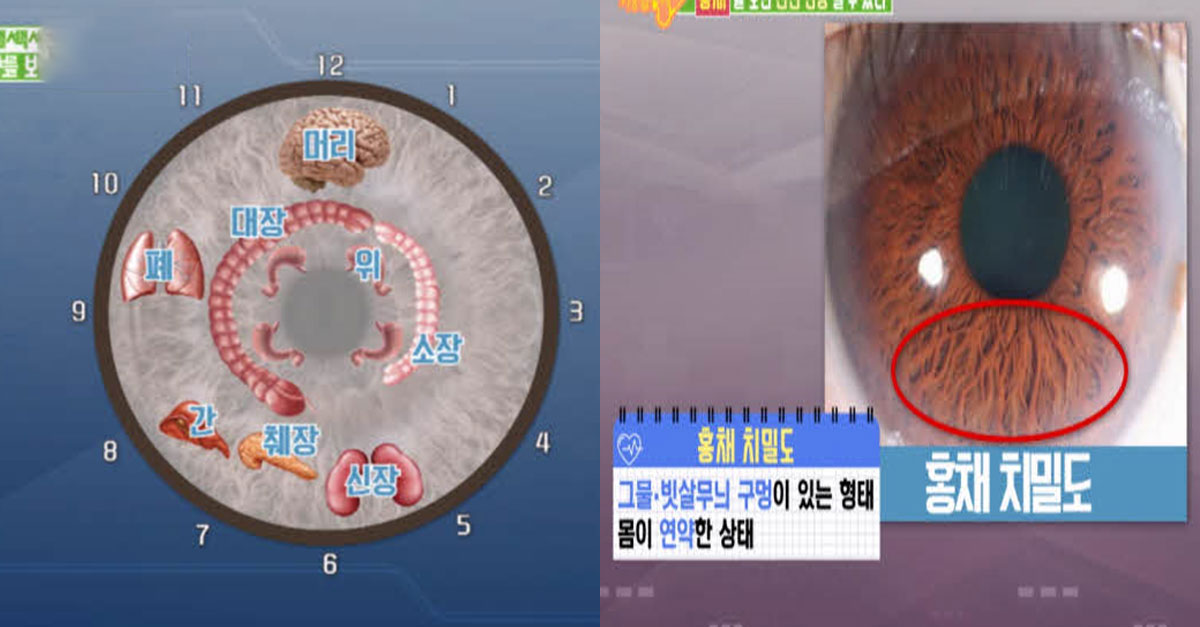 눈동자로 알아볼 수 있는 나의 ‘건강’ 상태