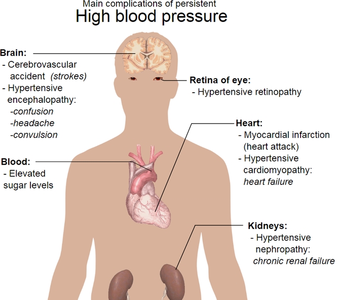 고혈압 합병증의 위험성과 합병증들