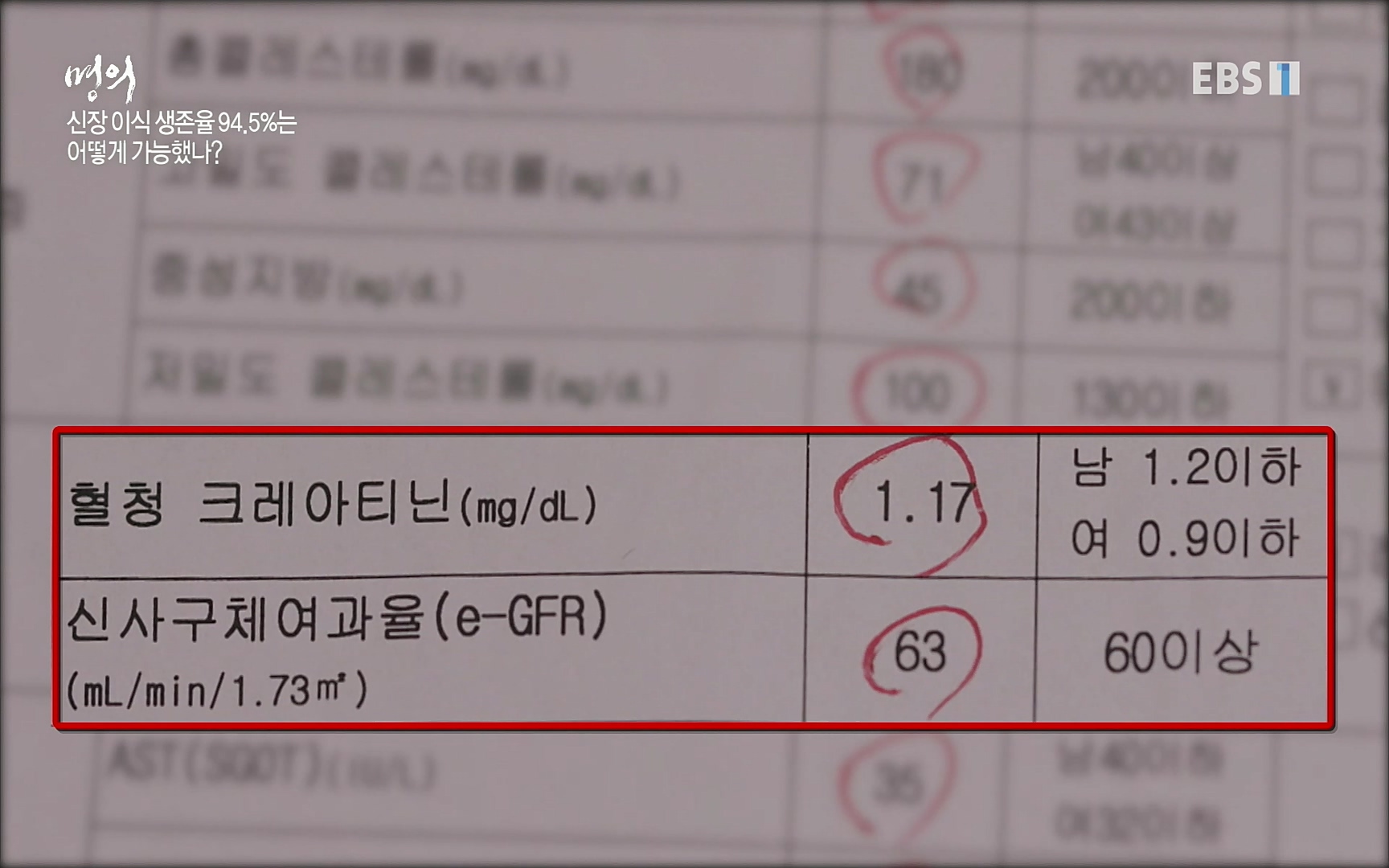 EBS 명의 헬스케어 - TV - 교육의 중심 EBS명의 15년 - 만성 콩팥병 치료, 어디까지 왔나- .mp4_20220802_205729.493.jpg