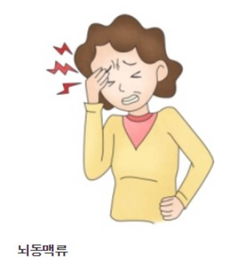 뇌동맥류 증상 사진