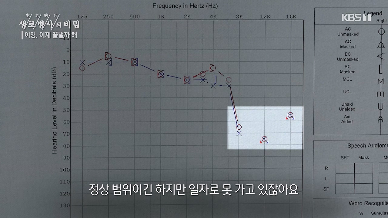 생로병사의 비밀.E883.230914p-NEXT.mp4_20230914_204614.113.jpg
