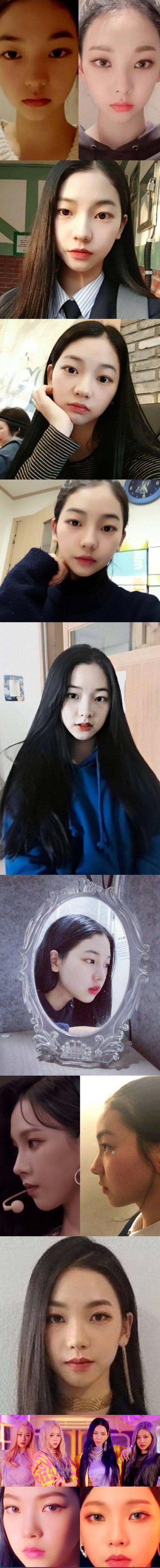  카리나 성형 리즈 과사 성형전