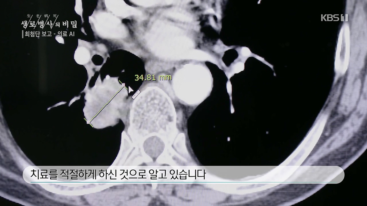 생로병사의 비밀.E869.230518p.H264-F1RST.mp4_20230518_200716.654.jpg