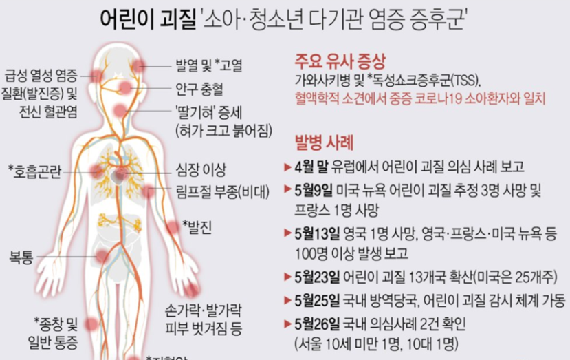  가와사키병(Kawasaki disease) 원인, 증상, 치료, 관련주 알아보기