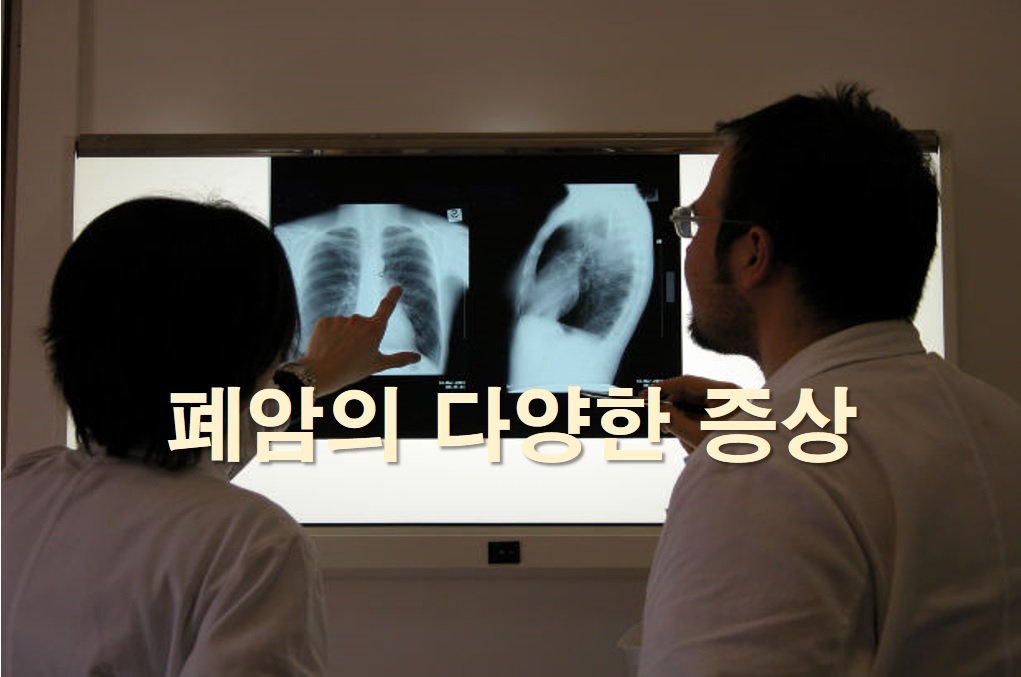  폐암의 두통, 오심, 구토 증상