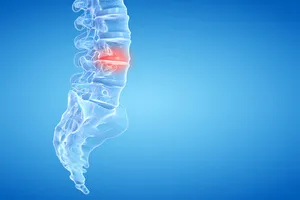 허리디스크 수술비용