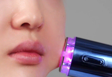 인모톡스 석션젯
