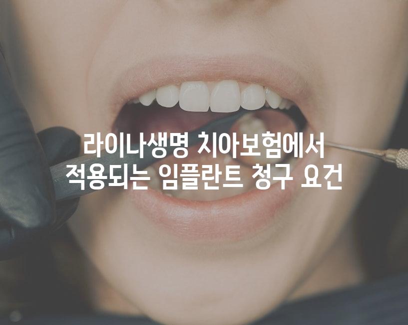 라이나생명 치아보험에서 적용되는 임플란트 청구 요건