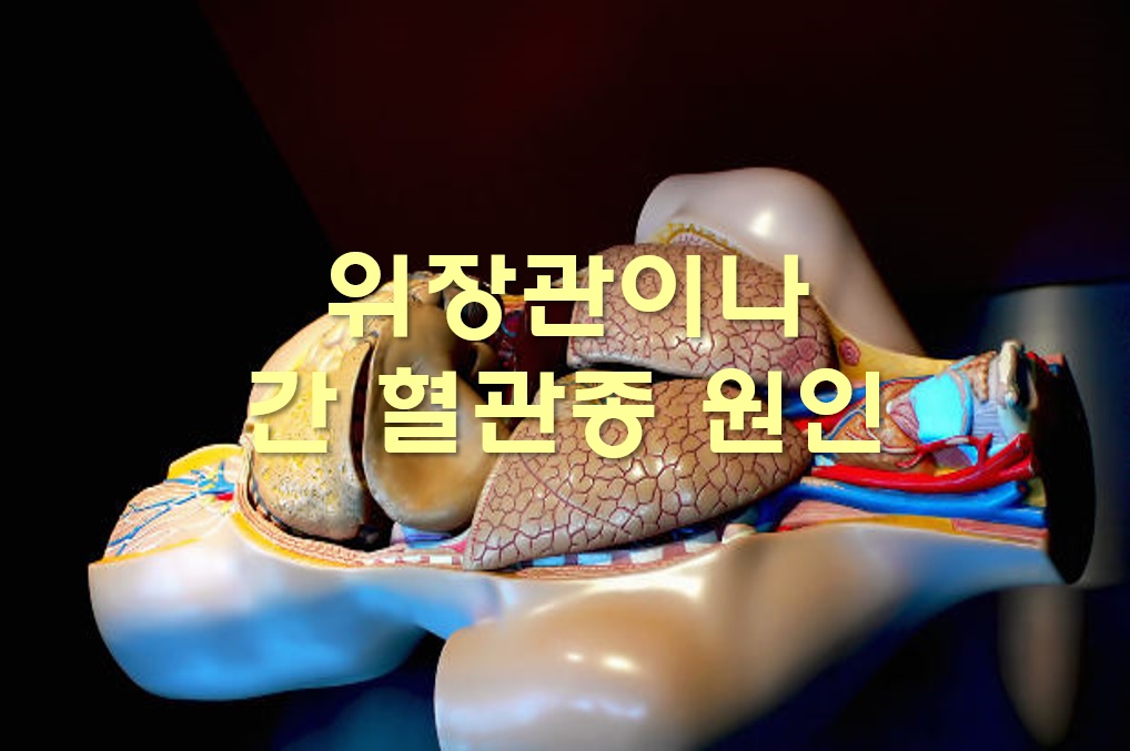  간 혈관종 원인과 증상