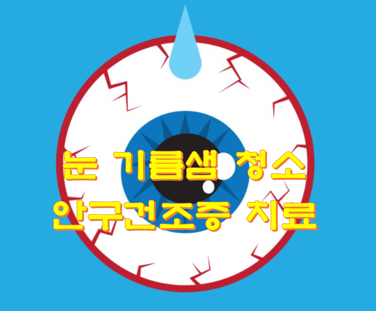  눈 기름샘 청소 안구건조증 치료