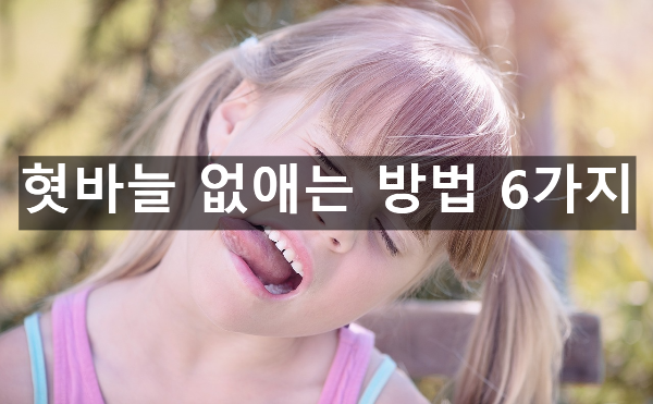  혓바늘 없애는 방법 6가지