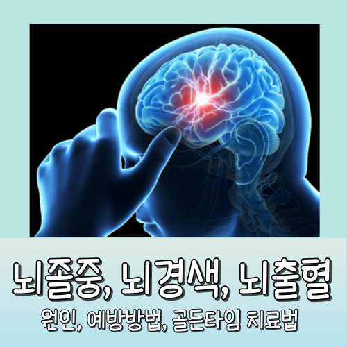 뇌졸중 뇌경색 뇌출혈 원인 예방방법 치료법 총정리