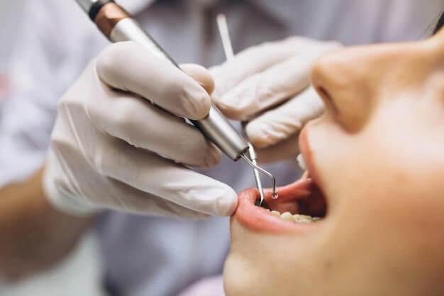 치과치료중인-사진