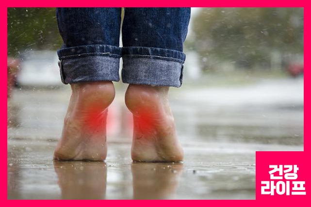 족저 근막염은 발뒤꿈치에서 발가락까지 뻗어 있는 고무줄과 같은 인대인 발바닥 근막에 생긴 염증입니다.