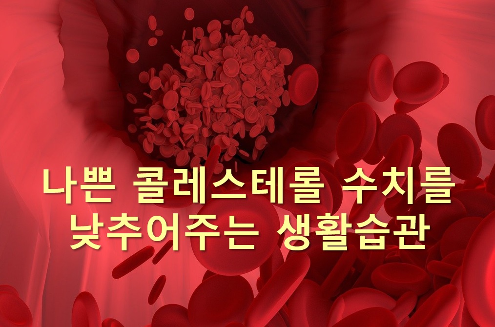  나쁜 콜레스테롤 수치를 낮추어주는 5가지 생활습관