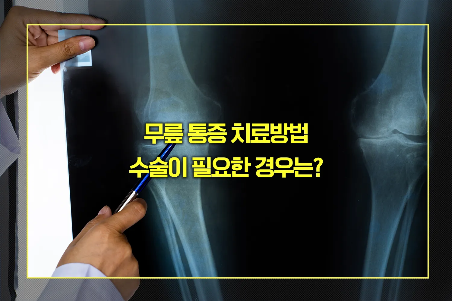 무릎 통증 수술이 필요한 경우