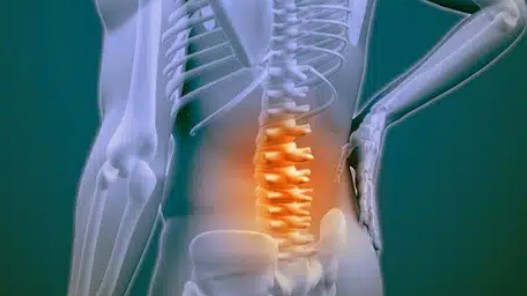 척추관협착증 원인과 증상, 치료방법, 관리, 운동