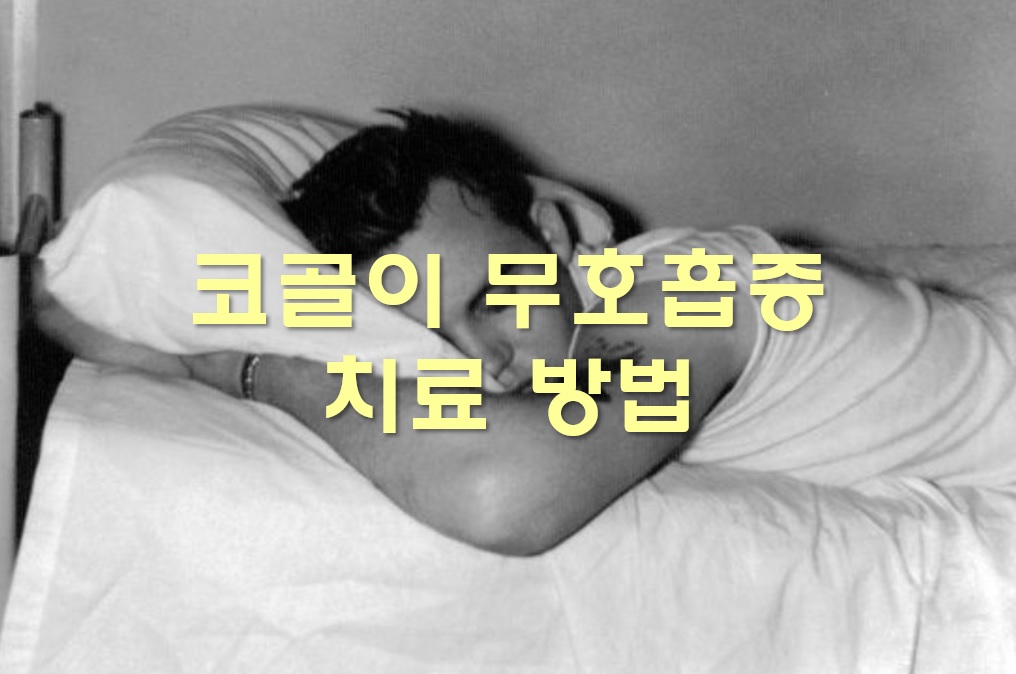  코골이 무호흡증 치료 방법과 수술비용