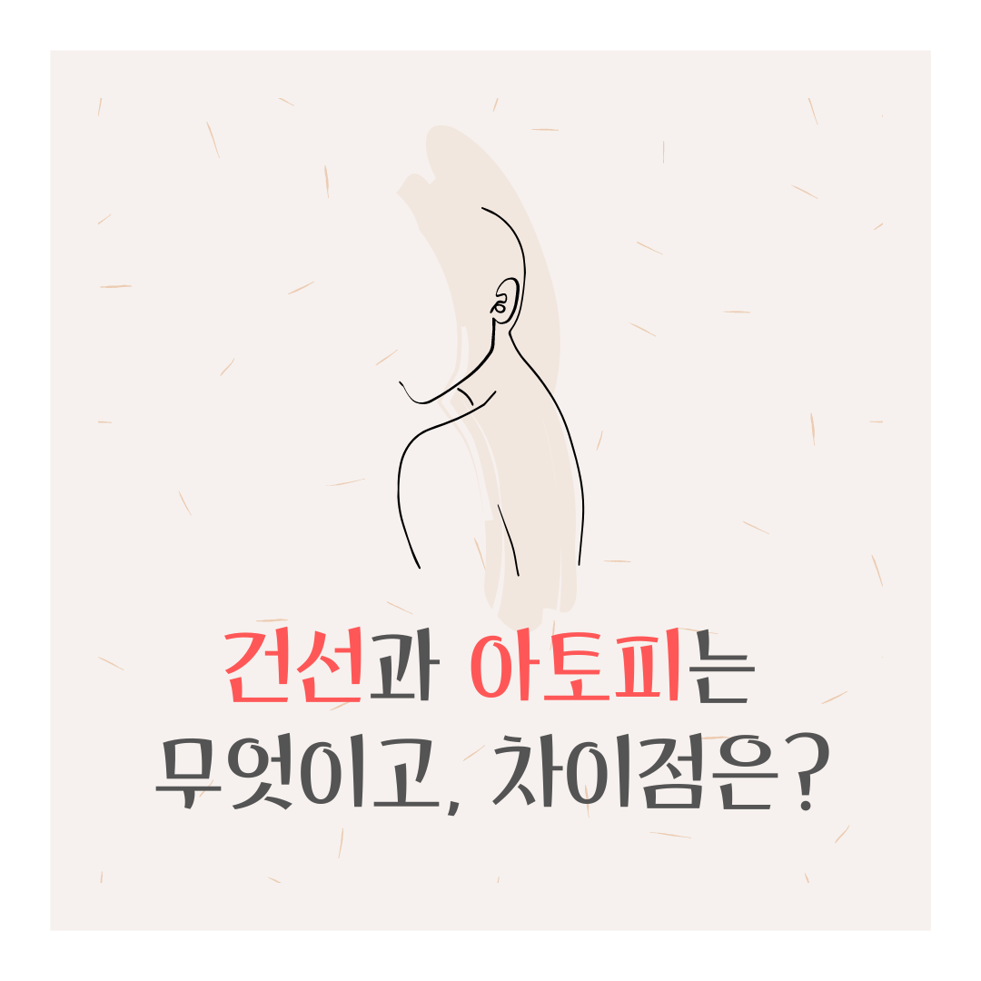  피부질환 건선은 무엇이고? 아토피피부염과의 차이점은?