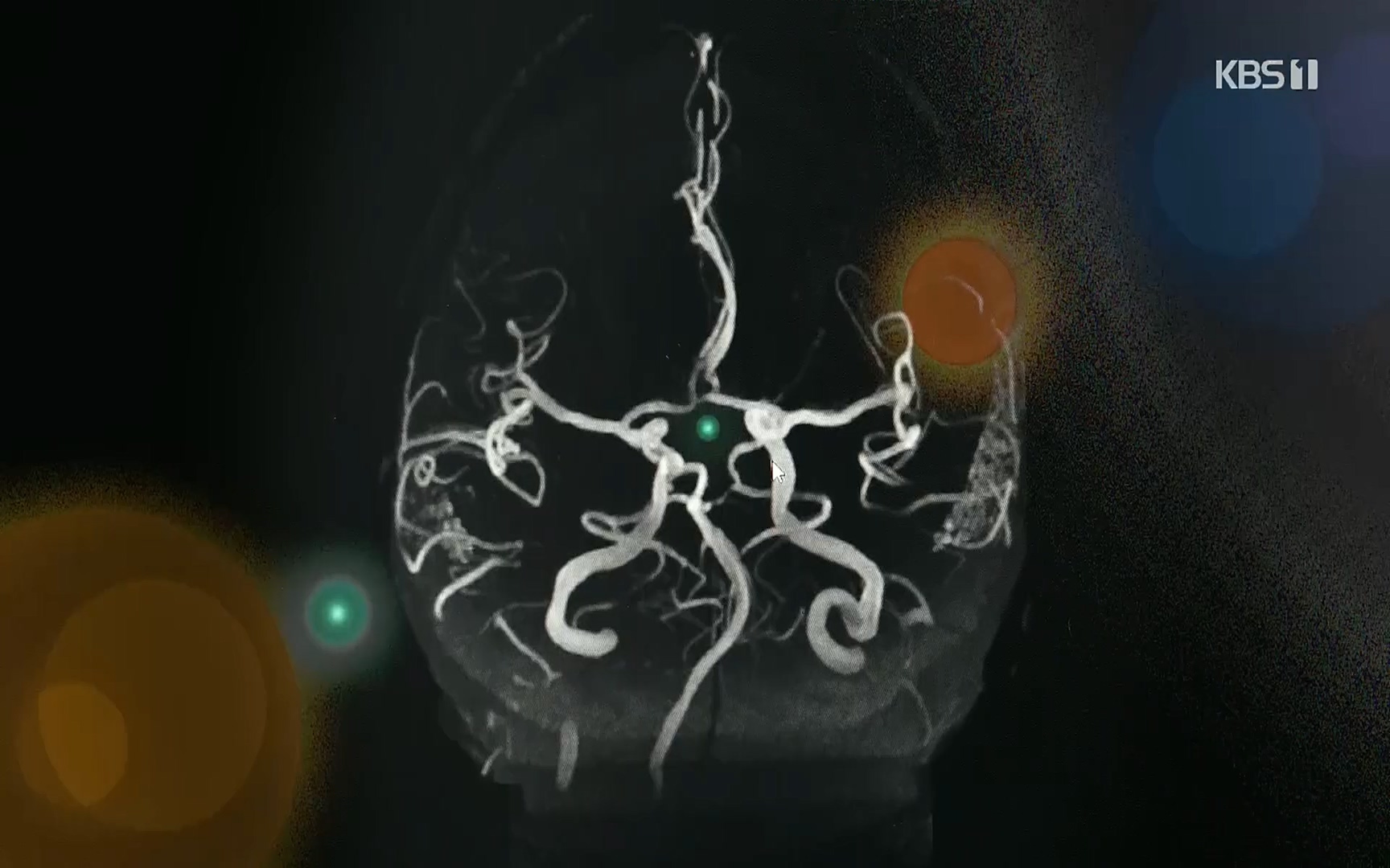 생로병사의 비밀.E835p.H264-F1RST.mp4_20220917_181731.137.jpg