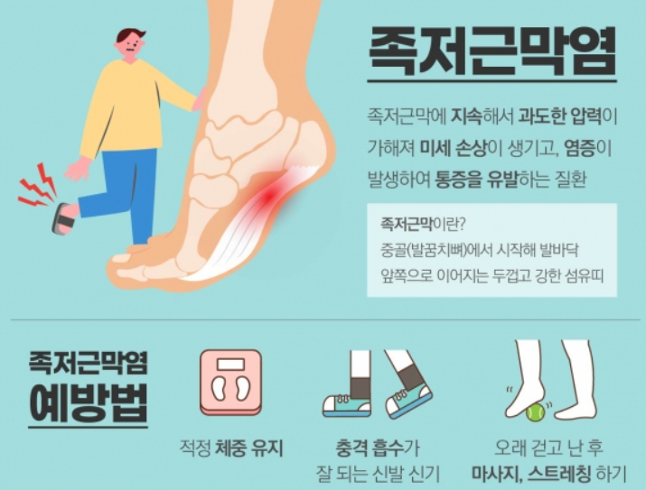 족저근막염