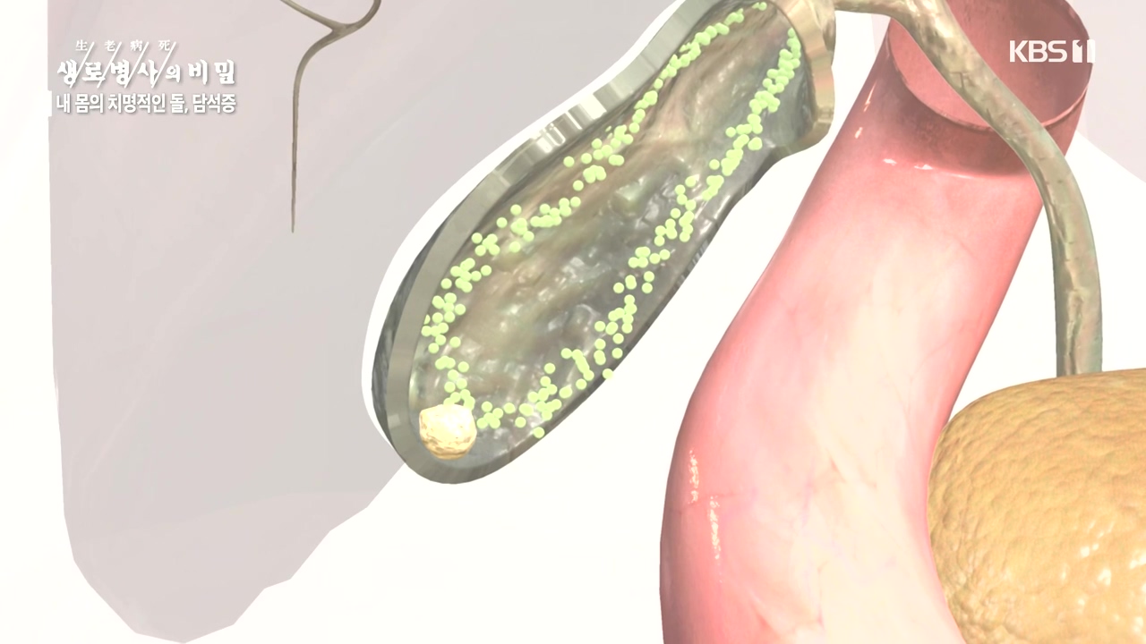 생로병사의 비밀.E886.231019p-NEXT.mp4_20231019_201729.435.jpg