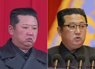  37세 김정은 맞나?…급격한 노화에 또다시 ‘건강이상설’