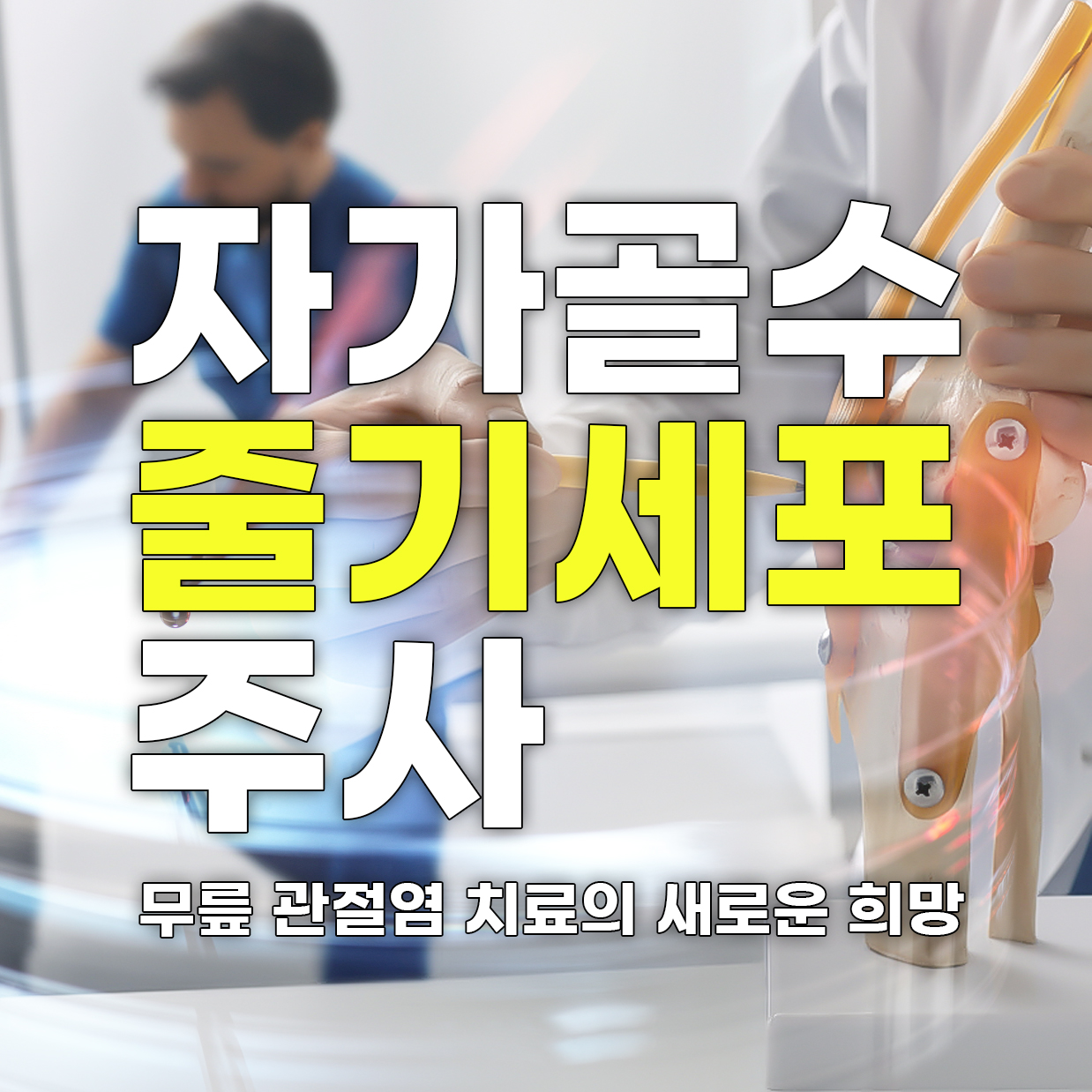  자가골수 줄기세포 주사: 무릎 관절염 치료의 새로운 희망