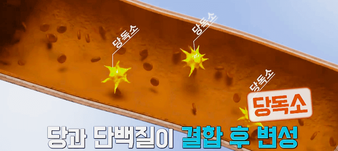  이명의 원인 당독소, 당독소만 쏙 빼주는 단식법 다이어트 효과까지