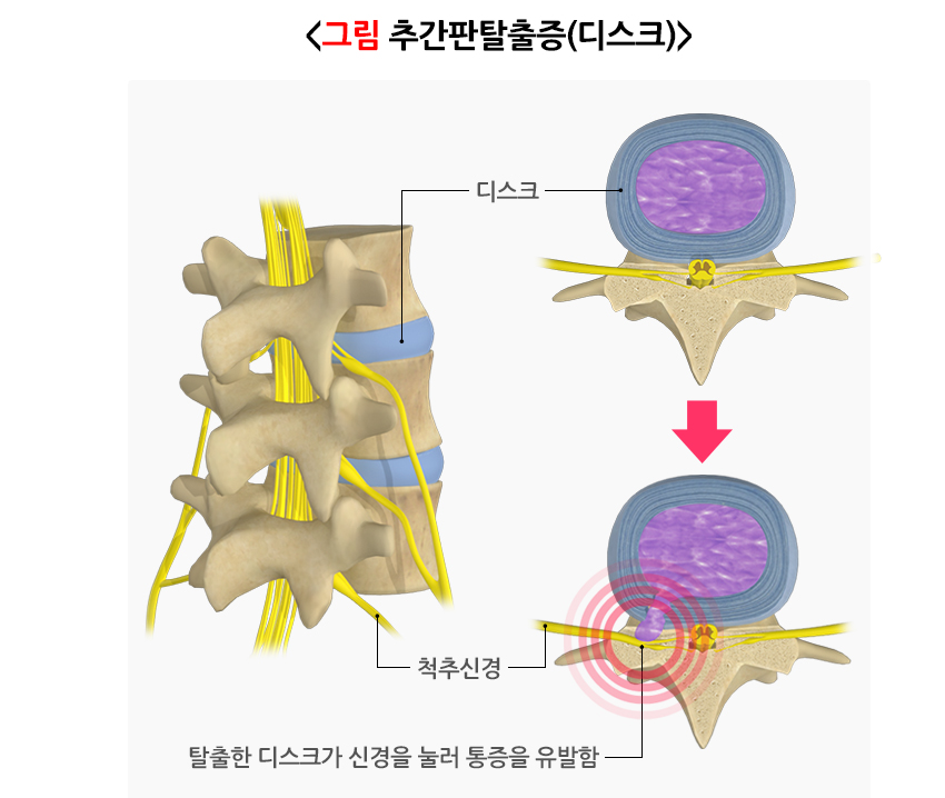 디스크설명