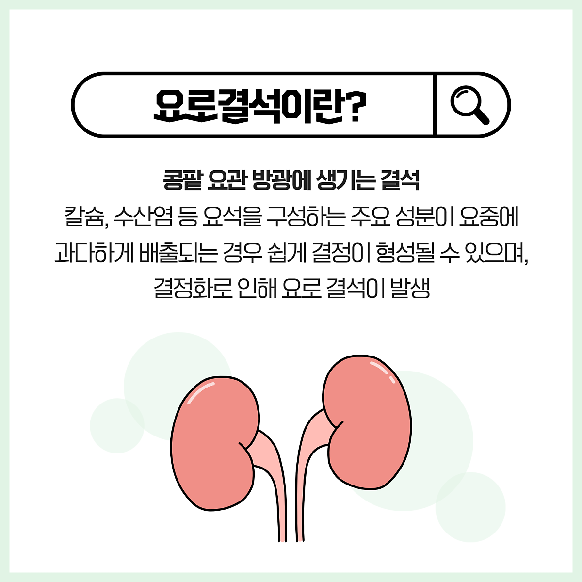 "죽음의 고통! 요로결석의 진짜 원인과 초간단 해결법 공개!"