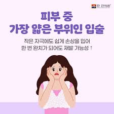 구순염 증상과 치료